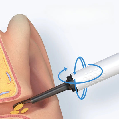 Safe-Reach Ear Hygiene